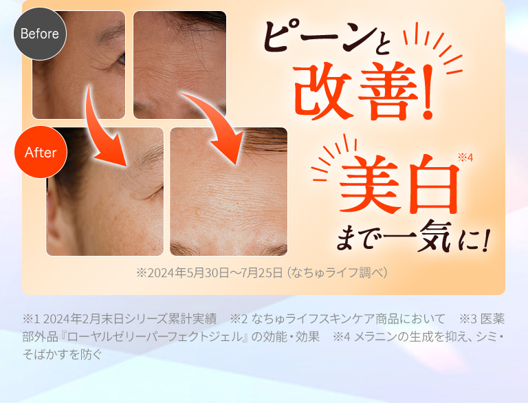 ピーンと改善美白まで一気に！※1 2024年2月末日シリーズ累計実績　※2 なちゅライフスキンケア商品において　※3 医薬部外品『ローヤルゼリーパーフェクトジェル』の効能・効果　※4 メラニンの生成を抑え、シミ・そばかすを防ぐ
